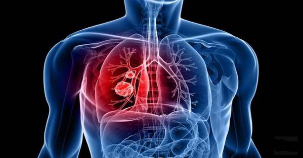5 technologies qui peuvent aider à la santé pulmonaire » JaypeeOnline
