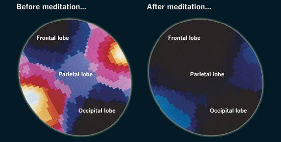 méditation modifie le cerveau