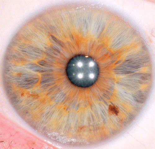 structure-de-votre -iris (3)