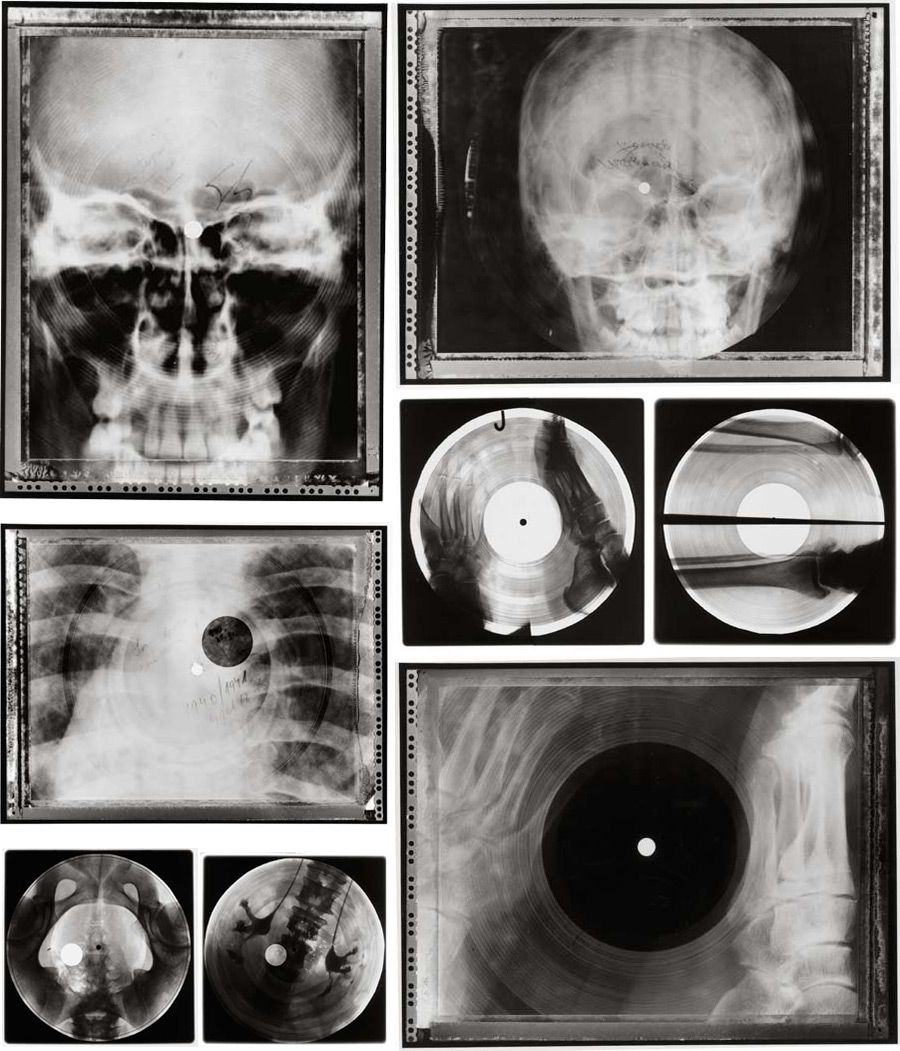 xray-3