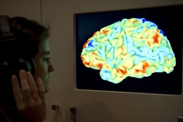 (Image prétexte) En observant le cerveau, les scientifiques zurichois ont pu établir un comportement différencié selon le genre. (Lundi 9 octobre 2017) 